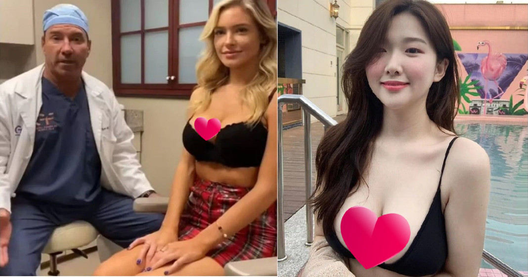 Vòng một luôn là chủ đề được CĐM quan tâm và tạo ra nhiều vụ việc 