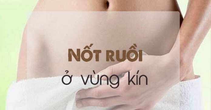 not-ruoi-o-vung-kin-nu-2 Giải mã bí ẩn và ý nghĩa của nốt ruồi ở vùng kín nữ