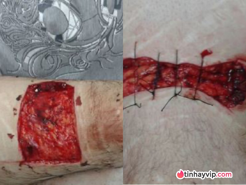 Lạnh gáy với những câu chuyện ăn thịt người thời hiện đại, sốc nhất trường hợp cuối Ăn thịt người tại Mỹ