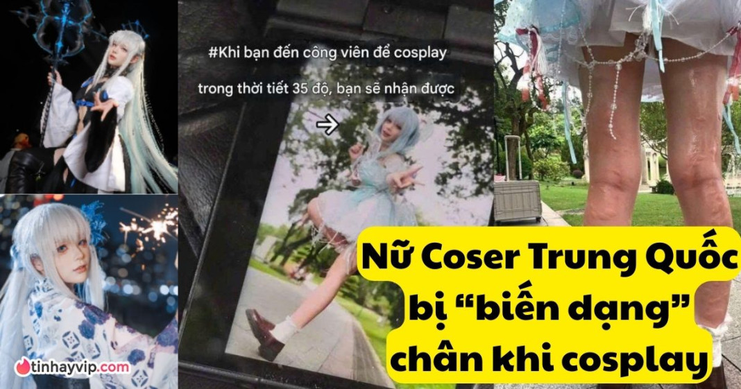 Nữ coser Otter Ki bị biến dạng chân khiến fan xót xa
