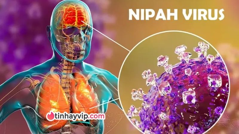 Cảnh báo Virus Nipah tại Ấn Độ có tỷ lệ tử vong cao