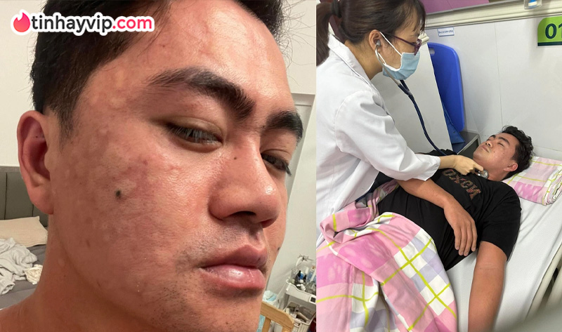 Bánh trứng kiến gây sốt MXH khiến nhiều người nhập viện vì sốc phản vệ